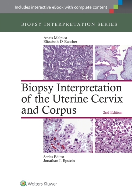 Biopsy Interpretation of the Uterine Cervix and Corpus, Hardback Book