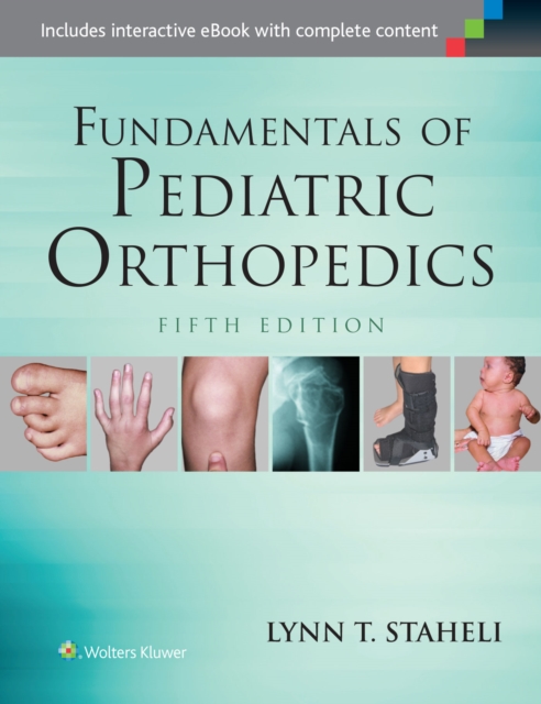 Fundamentals of Pediatric Orthopedics, Hardback Book