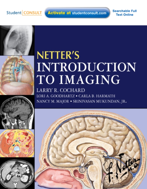 Netter's Introduction to Imaging E-Book : Netter's Introduction to Imaging E-Book, PDF eBook