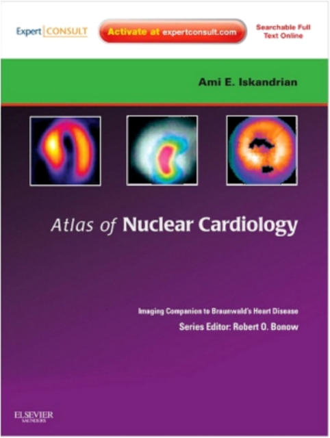 Atlas of Nuclear Cardiology: Imaging Companion to Braunwald's Heart Disease E-Book : Expert Consult - Online and Print, EPUB eBook