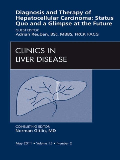 Hepatocellular Carcinoma, An Issue of Clinics in Liver Disease : Hepatocellular Carcinoma, An Issue of Clinics in Liver Disease, EPUB eBook