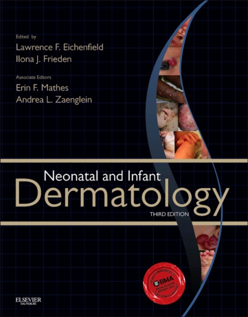 Neonatal and Infant Dermatology E-Book, EPUB eBook