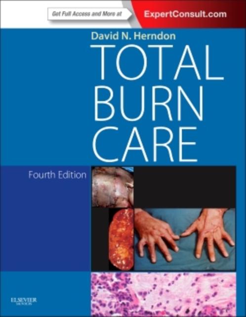 Total Burn Care E-Book : Expert Consult - Online, EPUB eBook