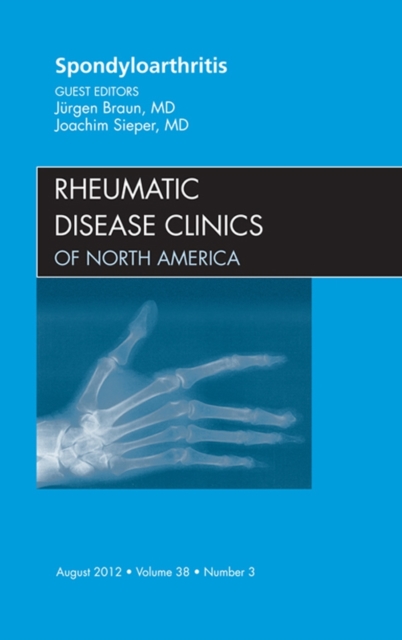 Spondyloarthropathies, An Issue of Rheumatic Disease Clinics, EPUB eBook