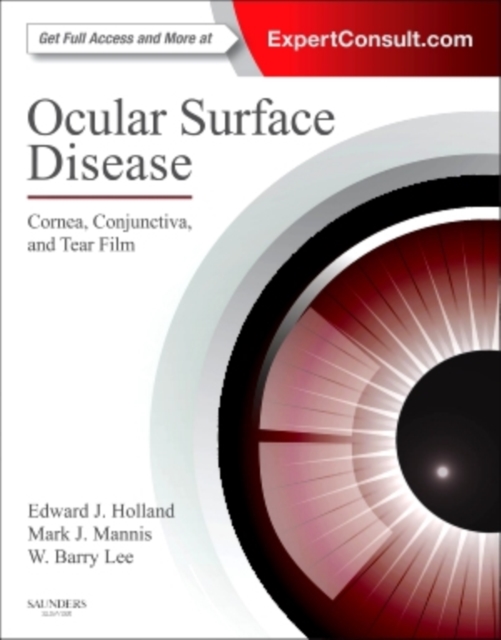 Ocular Surface Disease: Cornea, Conjunctiva and Tear Film E-Book : Expert Consult - Online and Print, EPUB eBook