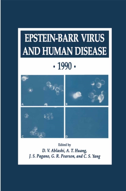 Epstein-Barr Virus and Human Disease * 1990, PDF eBook