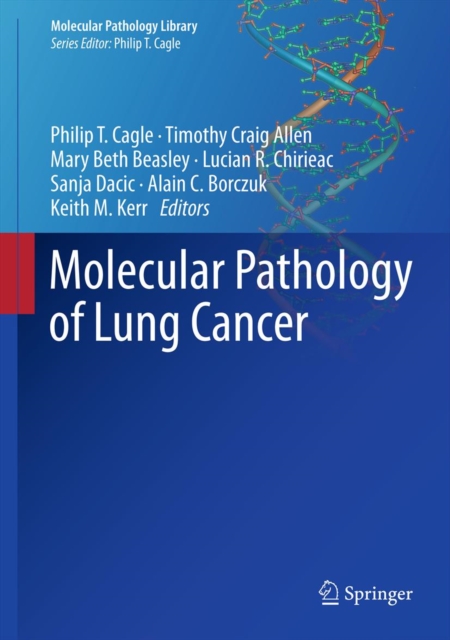 Molecular Pathology of Lung Cancer, PDF eBook