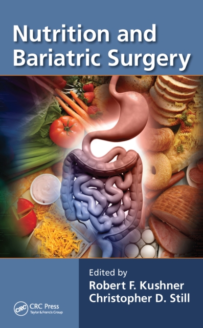 Nutrition and Bariatric Surgery, PDF eBook