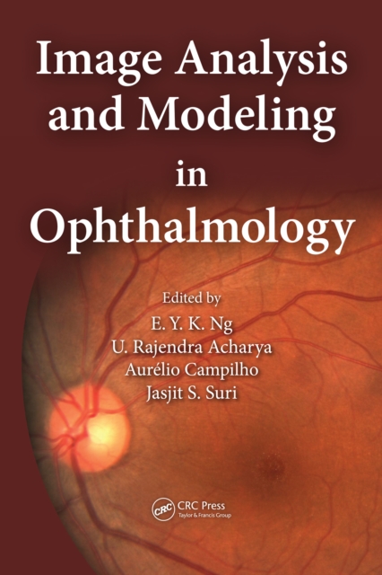 Image Analysis and Modeling in Ophthalmology, PDF eBook