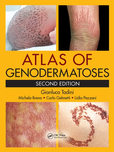 Atlas of Genodermatoses, PDF eBook