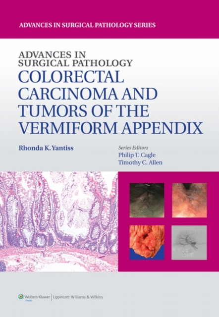 Advances in Surgical Pathology: Colorectal Carcinoma and Tumors of the Vermiform Appendix, EPUB eBook