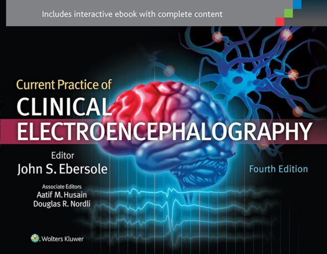 Current Practice of Clinical Electroencephalography, EPUB eBook