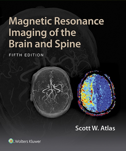 Magnetic Resonance Imaging of the Brain and Spine, EPUB eBook