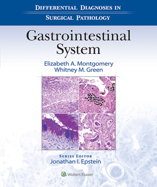 Differential Diagnoses in Surgical Pathology: Gastrointestinal System, EPUB eBook