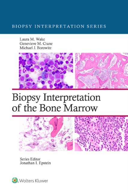 Biopsy Interpretation of the Bone Marrow, EPUB eBook