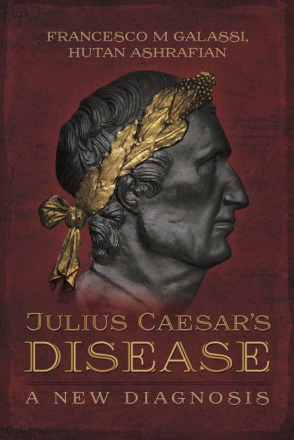 Julius Caesar's Disease : A New Diagnosis, EPUB eBook