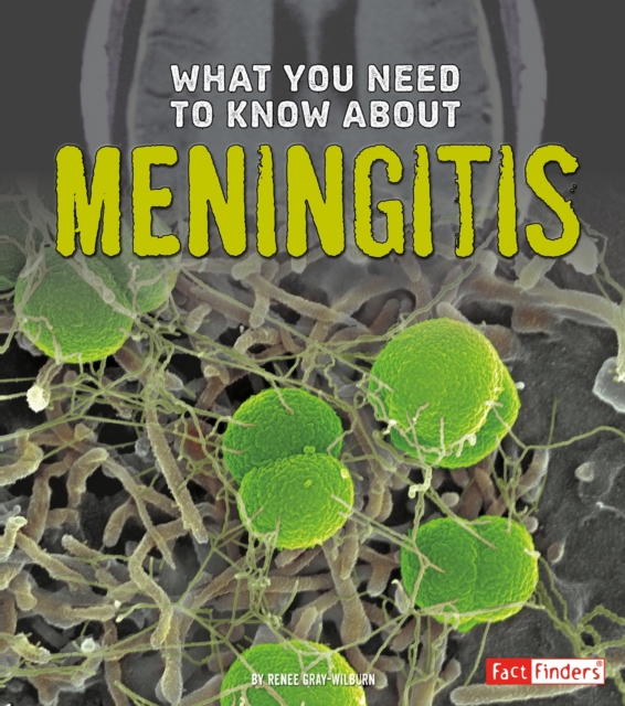 What You Need to Know about Meningitis, PDF eBook