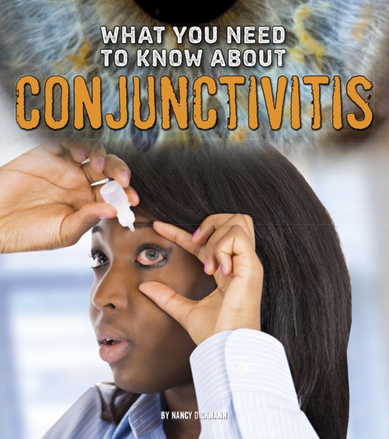 What You Need to Know about Conjunctivitis, PDF eBook