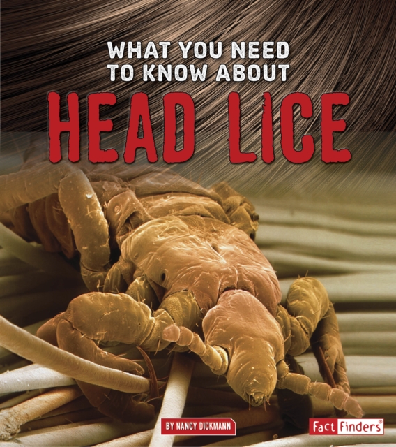 What You Need to Know about Head Lice, PDF eBook