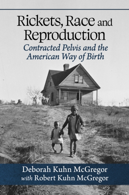 Rickets, Race and Reproduction : Contracted Pelvis and the American Way of Birth, EPUB eBook