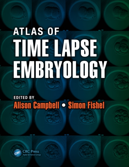 Atlas of Time Lapse Embryology, PDF eBook