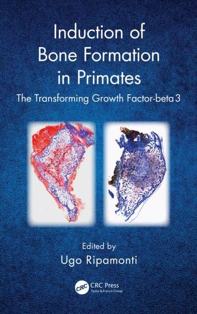 Induction of Bone Formation in Primates : The Transforming Growth Factor-beta 3, PDF eBook