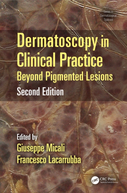 Dermatoscopy in Clinical Practice : Beyond Pigmented Lesions, PDF eBook