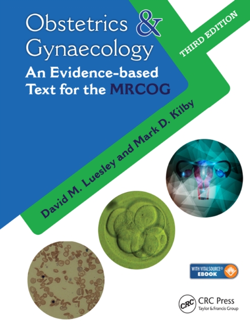 Obstetrics & Gynaecology : An Evidence-based Text for MRCOG, Third Edition, PDF eBook