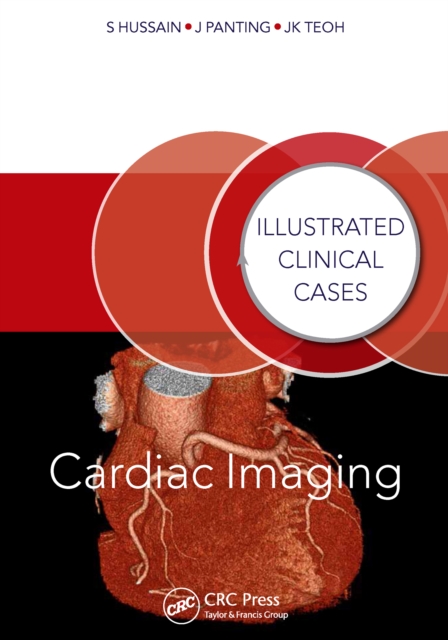 Cardiac Imaging : Illustrated Clinical Cases, PDF eBook