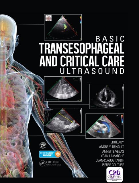 Basic Transesophageal and Critical Care Ultrasound, PDF eBook