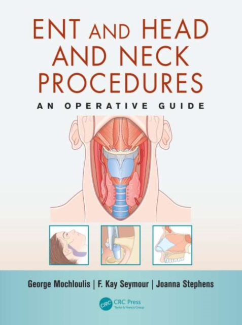 ENT and Head and Neck Procedures : An Operative Guide, PDF eBook