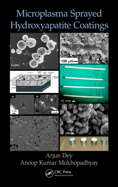 Microplasma Sprayed Hydroxyapatite Coatings, PDF eBook