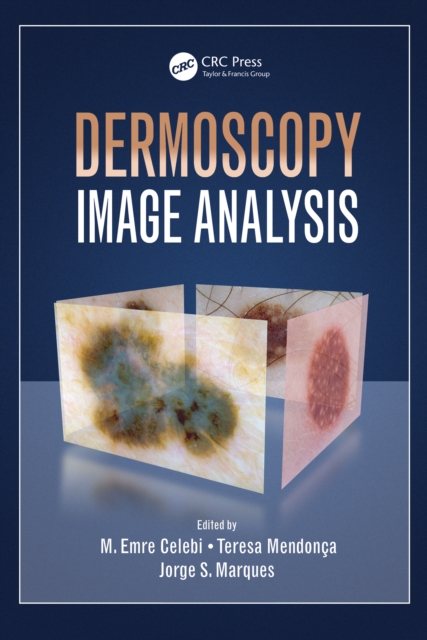 Dermoscopy Image Analysis, PDF eBook
