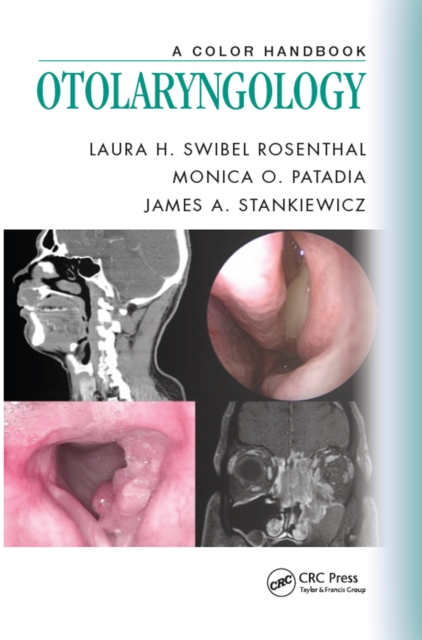 Otolaryngology : A Color Handbook, PDF eBook