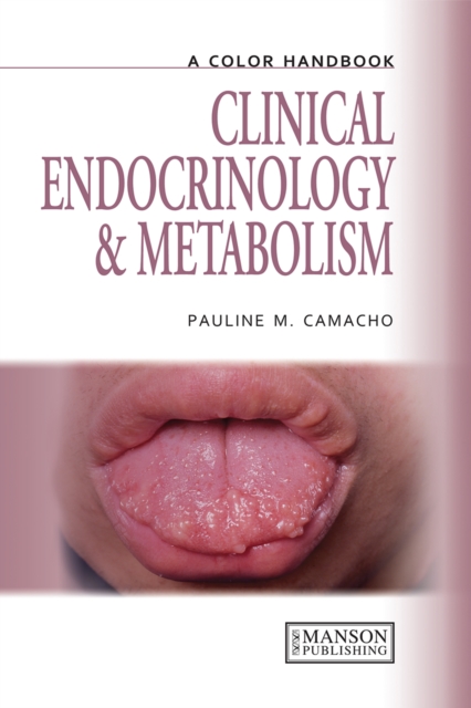 Clinical Endocrinology and Metabolism, EPUB eBook
