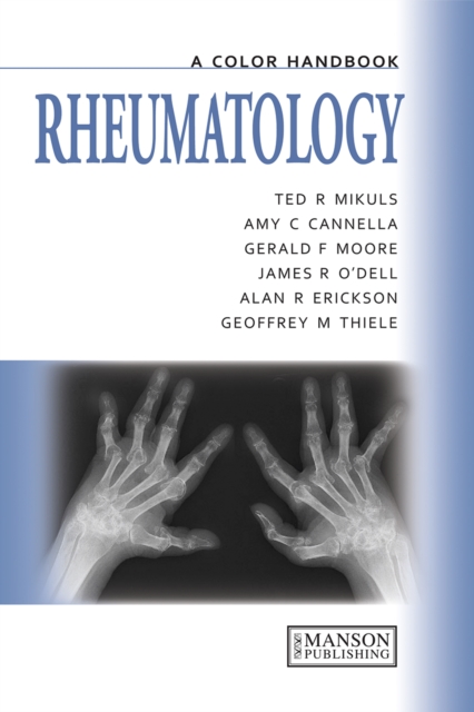 Rheumatology : A Color Handbook, EPUB eBook