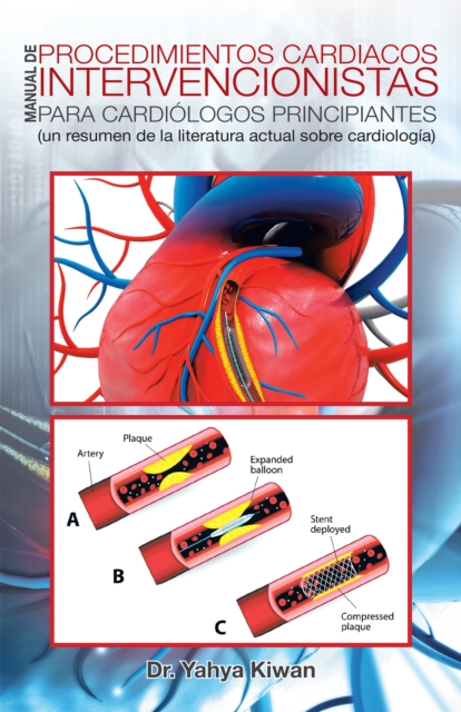 Manual De Procedimientos Cardiacos Intervencionistas Para Cardiologos Principiantes : (Un Resumen De La Literatura Actual Sobre Cardiologia), EPUB eBook