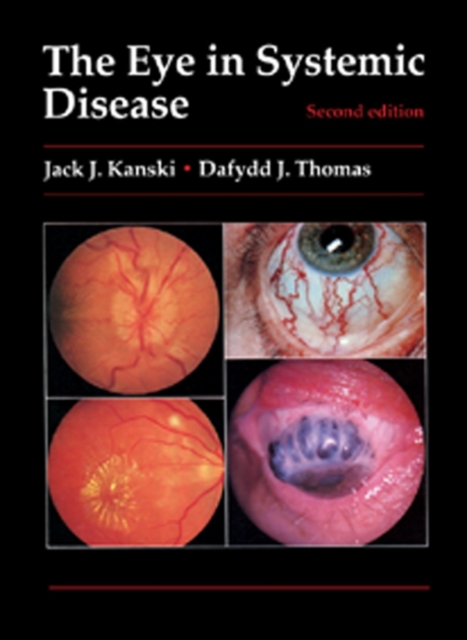 The Eye in Systemic Disease, EPUB eBook