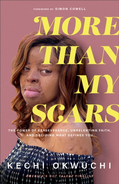 More Than My Scars : The Power of Perseverance, Unrelenting Faith, and Deciding What Defines You, EPUB eBook