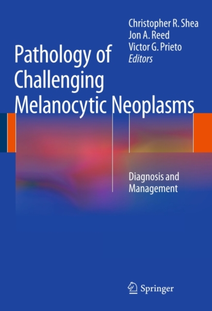 Pathology of Challenging Melanocytic Neoplasms : Diagnosis and Management, PDF eBook