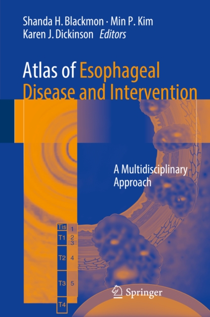 Atlas of Esophageal Disease and Intervention : A Multidisciplinary Approach, PDF eBook