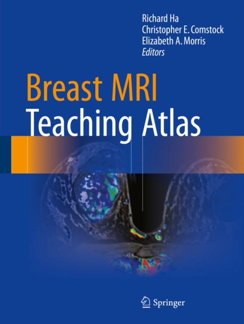 Breast MRI Teaching Atlas, EPUB eBook