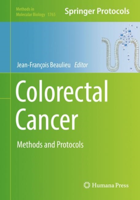Colorectal Cancer : Methods and Protocols, EPUB eBook