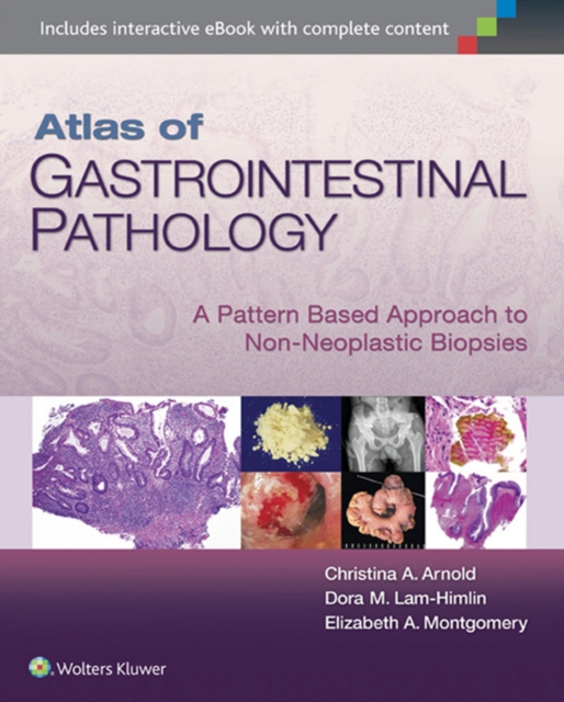 Atlas of Gastrointestinal Pathology : A Pattern Based Approach to Non-Neoplastic Biopsies, EPUB eBook