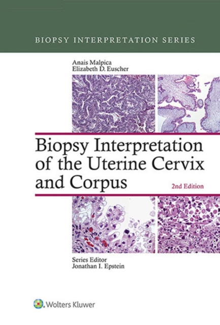 Biopsy Interpretation of the Uterine Cervix and Corpus, EPUB eBook