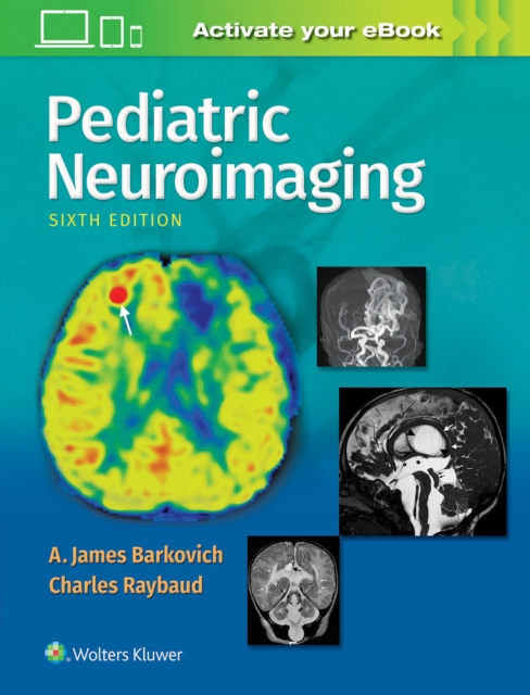 Pediatric Neuroimaging, Hardback Book