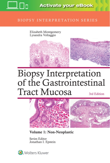 Biopsy Interpretation of the Gastrointestinal Tract Mucosa: Volume 1: Non-Neoplastic, Hardback Book