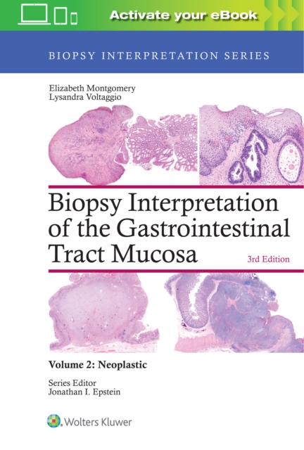 Biopsy Interpretation of the Gastrointestinal Tract Mucosa: Volume 2: Neoplastic, Hardback Book