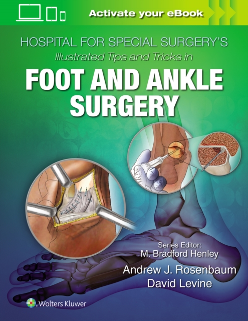 Hospital for Special Surgery's Illustrated Tips and Tricks in Foot and Ankle Surgery, Hardback Book