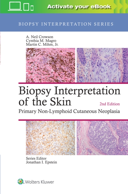 Biopsy Interpretation of the Skin : Primary Non-Lymphoid Cutaneous Neoplasia, Hardback Book